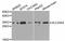ADP/ATP translocase 1 antibody, A1882, ABclonal Technology, Western Blot image 