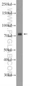 Zinc Finger Protein 549 antibody, 25592-1-AP, Proteintech Group, Western Blot image 