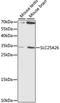 Solute Carrier Family 25 Member 26 antibody, A15557, ABclonal Technology, Western Blot image 