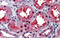 Ceramide Synthase 2 antibody, ARP32609_P050, Aviva Systems Biology, Immunohistochemistry paraffin image 