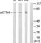ACTN4 antibody, TA311842, Origene, Western Blot image 