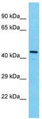 KIAA0895 Like antibody, TA337381, Origene, Western Blot image 