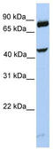 SET and MYND domain-containing protein 3 antibody, TA339751, Origene, Western Blot image 