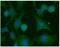 KRAS Proto-Oncogene, GTPase antibody, GTX31957, GeneTex, Immunocytochemistry image 