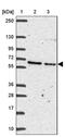 Advillin antibody, PA5-63621, Invitrogen Antibodies, Western Blot image 