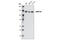 DNA Methyltransferase 3 Alpha antibody, 3598S, Cell Signaling Technology, Western Blot image 