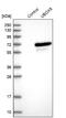 U-Box Domain Containing 5 antibody, NBP1-81469, Novus Biologicals, Western Blot image 
