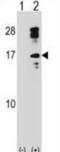 Charcot-Leyden Crystal Galectin antibody, abx028612, Abbexa, Western Blot image 