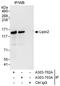 Phosphatidate phosphatase LPIN2 antibody, A303-703A, Bethyl Labs, Immunoprecipitation image 