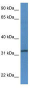 Tetraspanin 33 antibody, TA334092, Origene, Western Blot image 