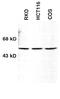 Serine/threonine-protein kinase Chk1 antibody, AP05017PU-N, Origene, Western Blot image 