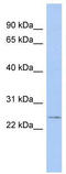Ecotropic Viral Integration Site 2A antibody, TA334296, Origene, Western Blot image 