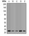 Quinoid Dihydropteridine Reductase antibody, orb340960, Biorbyt, Western Blot image 