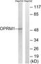 Oprm antibody, A30903, Boster Biological Technology, Western Blot image 