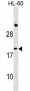Interferon alpha-1/13 antibody, abx030045, Abbexa, Western Blot image 