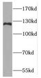 F-box only protein 18 antibody, FNab03039, FineTest, Western Blot image 