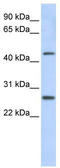 PRAME Family Member 10 antibody, TA334974, Origene, Western Blot image 