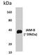 Junctional Adhesion Molecule 2 antibody, GTX52880, GeneTex, Western Blot image 