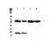 UDP Glucuronosyltransferase Family 1 Member A1 antibody, A01865-1, Boster Biological Technology, Western Blot image 