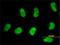 SWI/SNF Related, Matrix Associated, Actin Dependent Regulator Of Chromatin, Subfamily D, Member 2 antibody, H00006603-M02, Novus Biologicals, Immunofluorescence image 