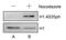 Histone Cluster 1 H1 Family Member E antibody, PA5-31907, Invitrogen Antibodies, Western Blot image 