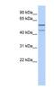 Zinc Finger Protein 474 antibody, NBP1-79993, Novus Biologicals, Western Blot image 