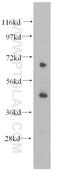 Potassium Voltage-Gated Channel Subfamily J Member 11 antibody, 16920-1-AP, Proteintech Group, Western Blot image 
