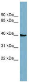 Solute Carrier Family 35 Member D3 antibody, TA334147, Origene, Western Blot image 