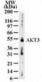 RAC-gamma serine/threonine-protein kinase antibody, TA336674, Origene, Western Blot image 