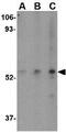 Sp110 nuclear body protein antibody, GTX85042, GeneTex, Western Blot image 