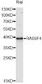 Ras Association Domain Family Member 4 antibody, A11193-1, Boster Biological Technology, Western Blot image 