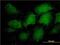 Proteasome 20S C2 antibody, H00005682-M01, Novus Biologicals, Immunofluorescence image 