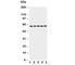 Tumor Protein P63 antibody, R31167, NSJ Bioreagents, Western Blot image 