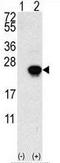 Heparin-binding growth factor 1 antibody, GTX81891, GeneTex, Western Blot image 