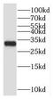 Cilia And Flagella Associated Protein 300 antibody, FNab01008, FineTest, Western Blot image 