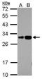 RILP-like protein 2 antibody, GTX121000, GeneTex, Western Blot image 
