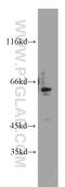 Zinc Finger Protein 671 antibody, 21329-1-AP, Proteintech Group, Western Blot image 