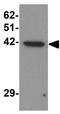Zinc Finger And BTB Domain Containing 6 antibody, GTX17096, GeneTex, Western Blot image 