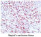 Human Herpes Virus 8 antibody, MBS200144, MyBioSource, Immunohistochemistry paraffin image 