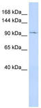 Short transient receptor potential channel 6 antibody, TA338540, Origene, Western Blot image 