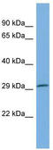 Proteasome Subunit Beta 8 antibody, TA339265, Origene, Western Blot image 