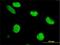 Zinc Finger Protein 207 antibody, H00007756-M02, Novus Biologicals, Immunofluorescence image 