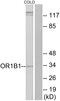 Olfactory Receptor Family 1 Subfamily B Member 1 (Gene/Pseudogene) antibody, GTX87177, GeneTex, Western Blot image 