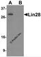 Lin-28 Homolog A antibody, PM-6143, ProSci, Western Blot image 