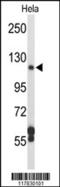 Dipeptidyl Peptidase 8 antibody, 62-286, ProSci, Western Blot image 