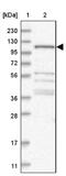 WD Repeat Domain 47 antibody, NBP1-81463, Novus Biologicals, Western Blot image 
