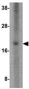 Upper Zone Of Growth Plate And Cartilage Matrix Associated antibody, GTX85279, GeneTex, Western Blot image 