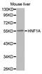 HNF1 Homeobox A antibody, MBS127927, MyBioSource, Western Blot image 