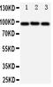 ATP Binding Cassette Subfamily B Member 6 (Langereis Blood Group) antibody, PA1723, Boster Biological Technology, Western Blot image 