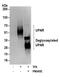 Plasminogen Activator, Urokinase Receptor antibody, A304-463A, Bethyl Labs, Western Blot image 